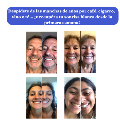 Smilekit V34 Colour Corrector