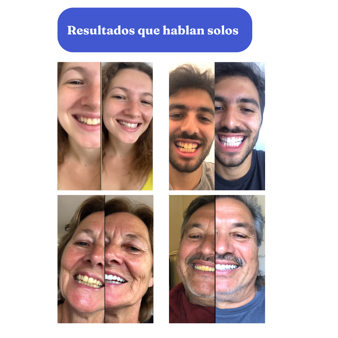 Smilekit V34 Colour Corrector