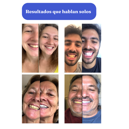 Smilekit V34 Colour Corrector