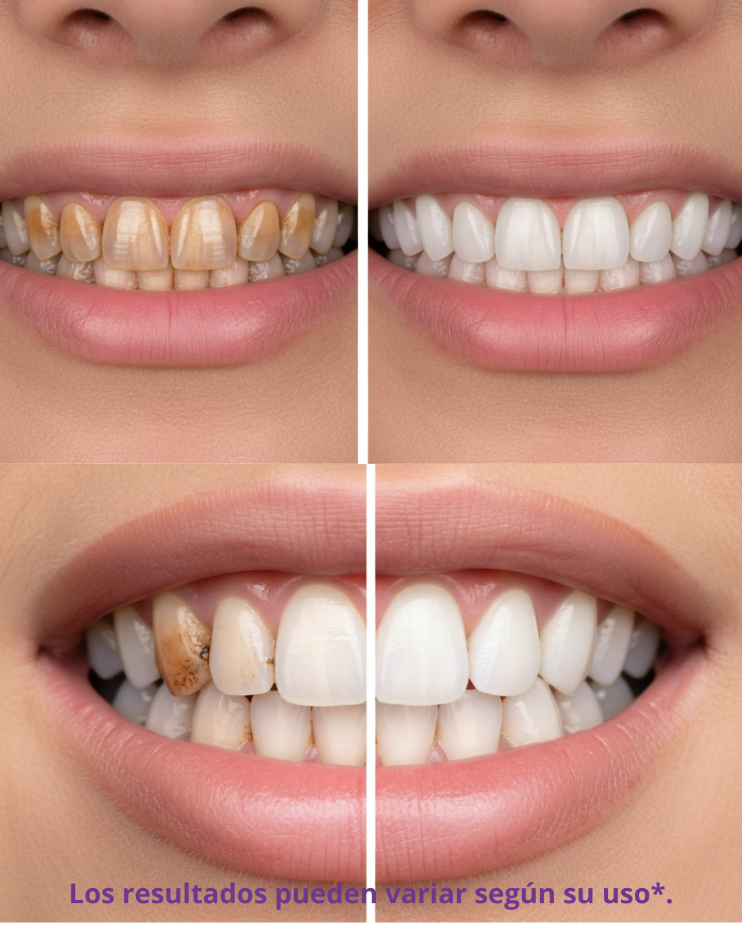 🦷 SmileUp™ PurpleFix™ – Blanqueador Dental Instantáneo en Pasta Elimina manchas y aclara tus dientes desde el primer uso