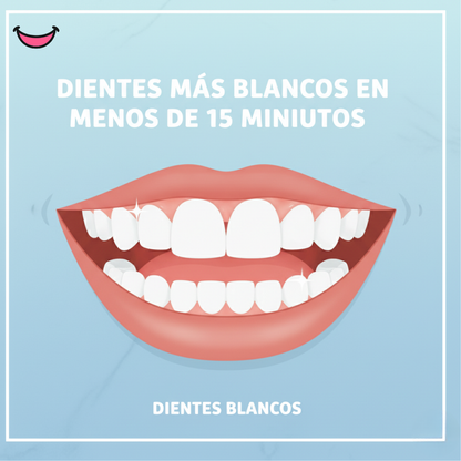 💎 SmileUp™ Diamond Series – Kit Blanqueador Dental LED Inalámbrico | 4 Serums PAP+ Recargables