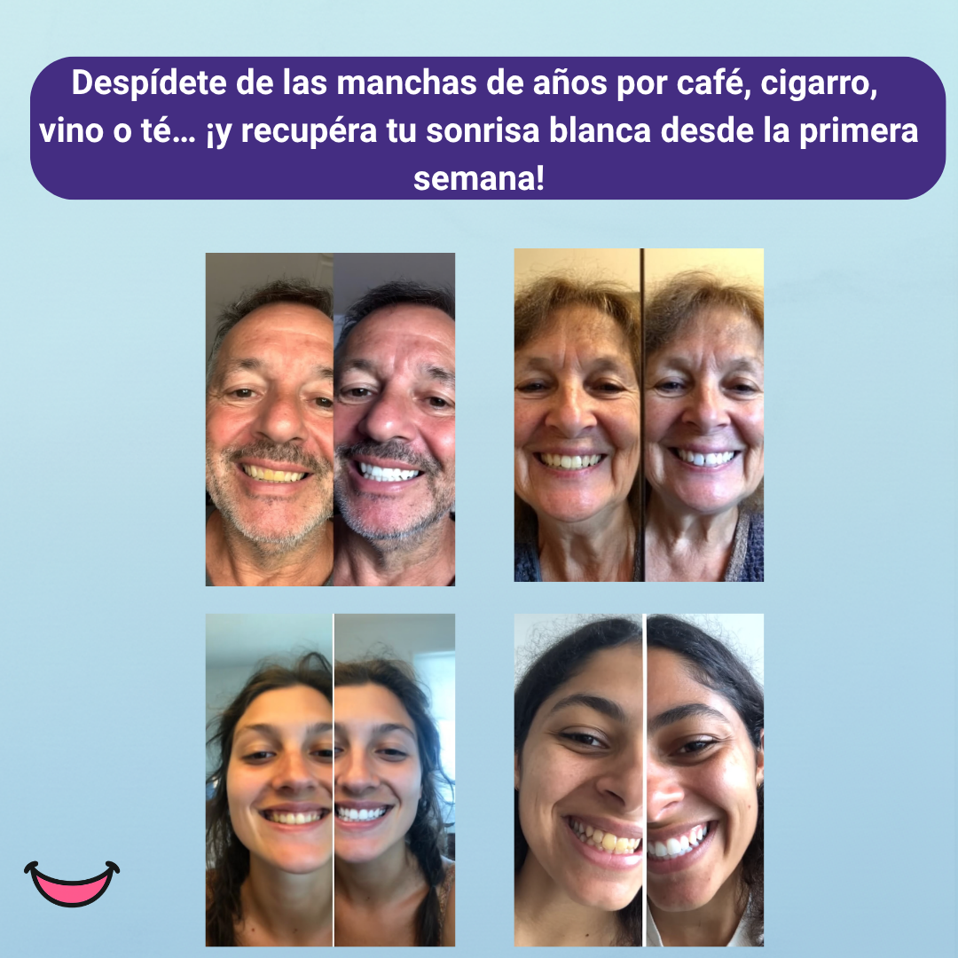 💎 SmileUp™ Diamond Series – Kit Blanqueador Dental LED Inalámbrico | 4 Serums PAP+ Recargables