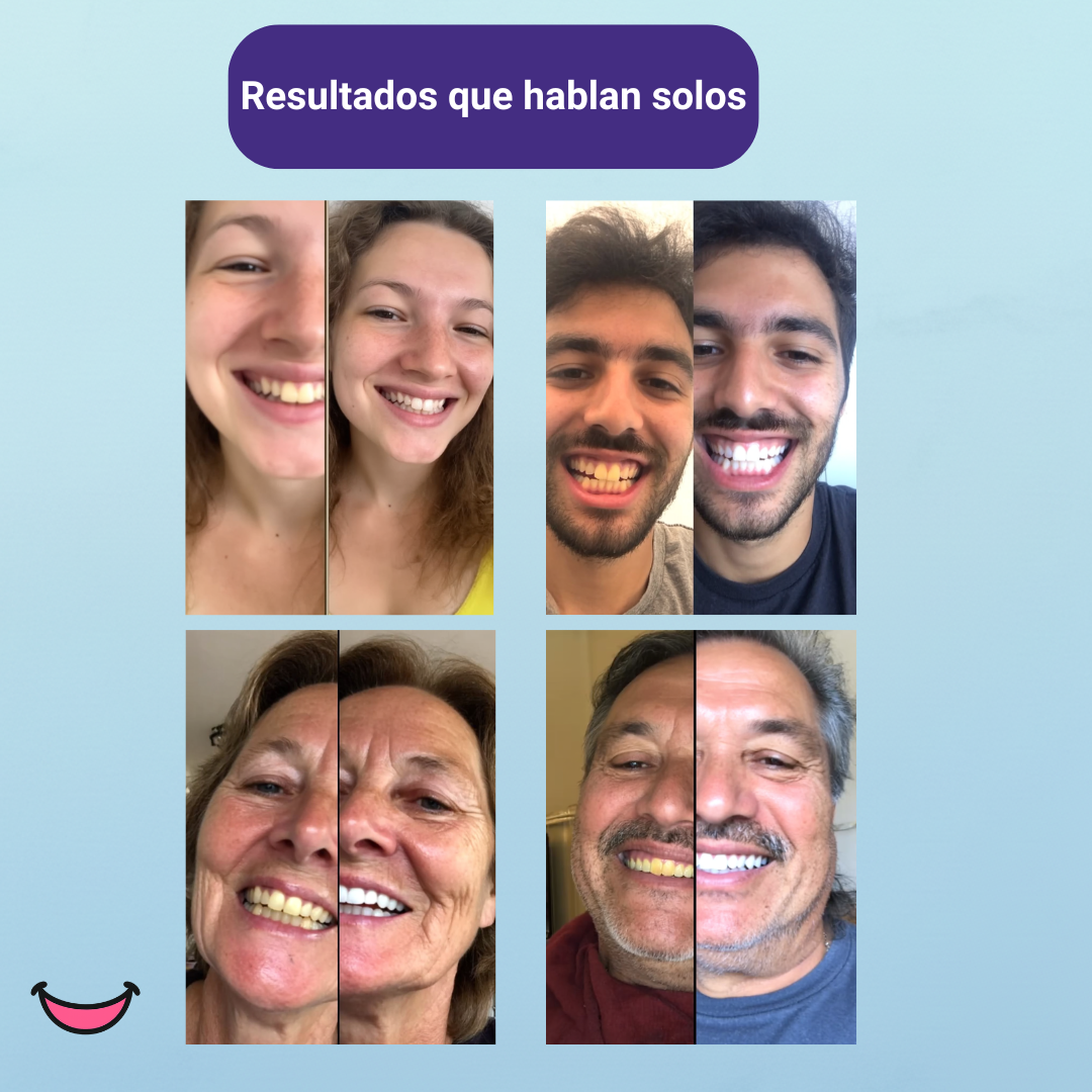 💎 SmileUp™ Diamond Series – Kit Blanqueador Dental LED Inalámbrico | 4 Serums PAP+ Recargables